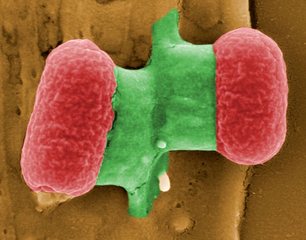 This handout image made available by the "Helmholtz-Zentrum für Infektionsforschung (HZI)" on May 26, 2011 shows the E. coli (EHEC) bacteria. Germany has warned consumers to be especially careful when eating tomatoes, lettuce, and cucumbers which are believed to be responsible for an outbreak of food poisoning that has left three dead. AFP PHOTO HO / Manfred Rohde, Helmholtz-Zentrum für Infektionsforschung (HZI)" RESTRICTED TO EDITORIAL USE - MANDATORY CREDIT " NO MARKETING NO ADVERTISING CAMPAIGNS - DISTRIBUTED AS A SERVICE TO CLIENTS