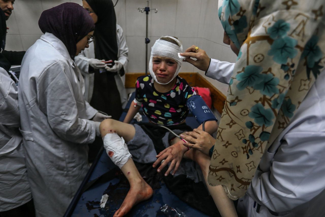 Un niño palestino con quemaduras en un hospital de Gaza tras un ataque con cohetes israelí. 