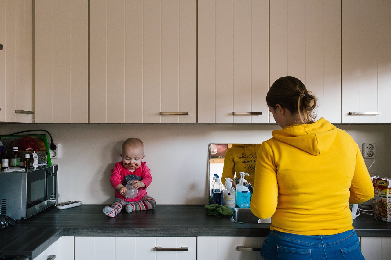 De broze huid van deze kinderen betekent een leven vol ongemak 