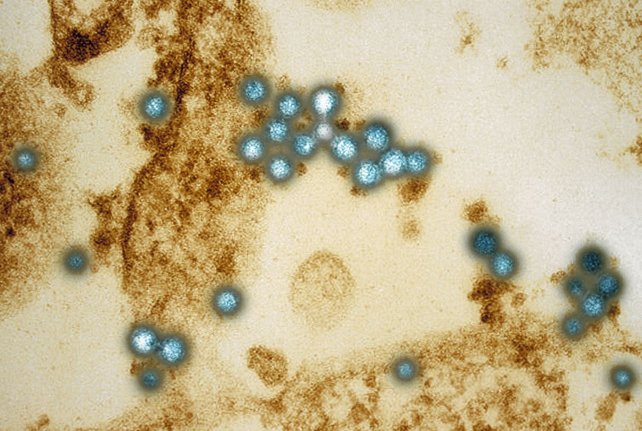 Het westnijlvirus gezien met behulp van een elektronenmicroscoop.
