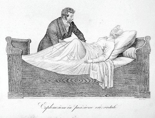 Een arts doet onderzoek bij een vrouw, prent van rond 1800.