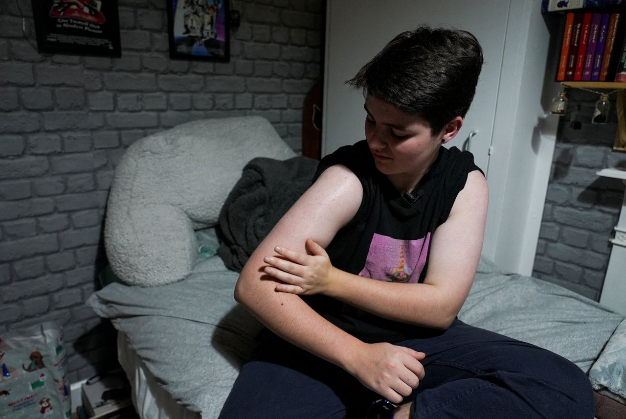 Miles Pitcher, een Britse zeventienjarige transgender, brengt testosterone gel aan op zijn arm.