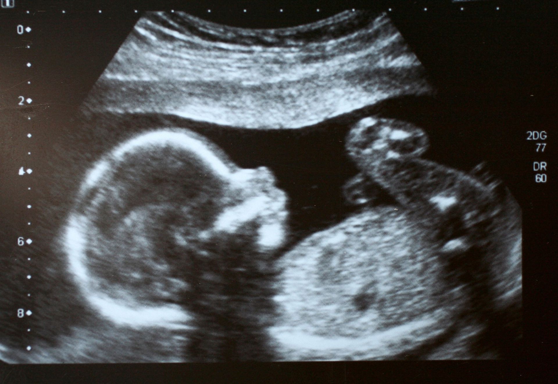 Фото ребенка 6 месяцев в животе