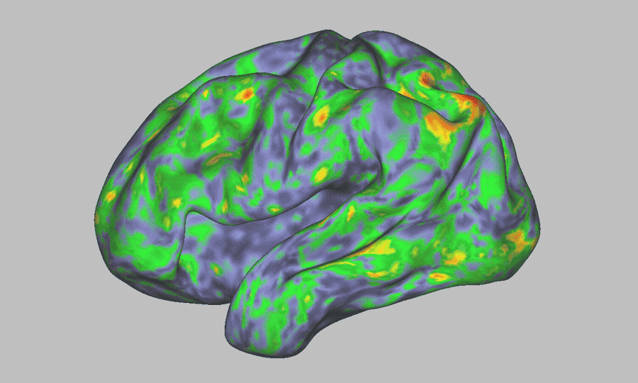Trippend in de scanner: psilocybine heeft wekenlang effect op brein 