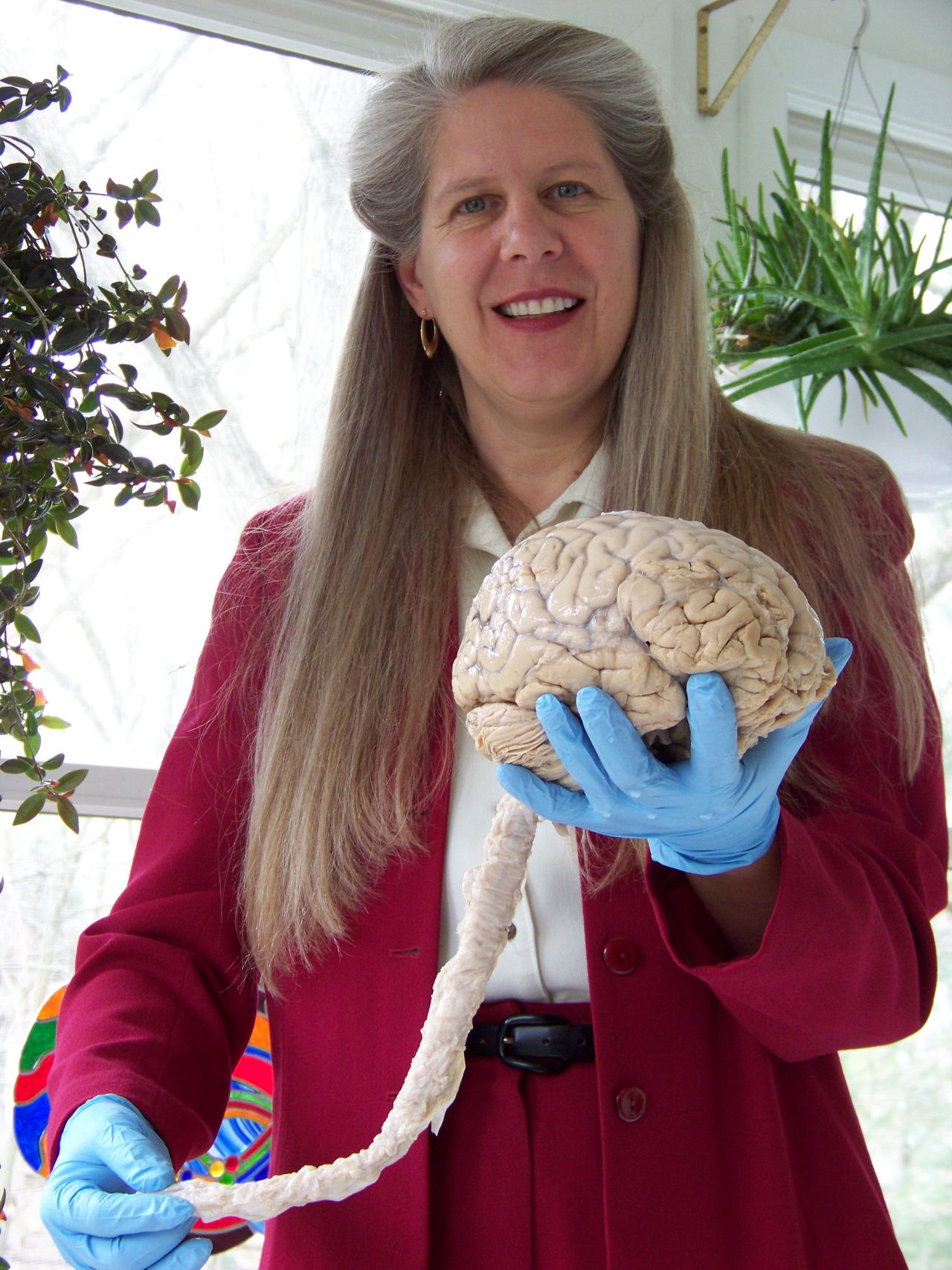 Neuroanatoom Jill Bolte Taylor met in haar handen hersens en ruggenmerg.