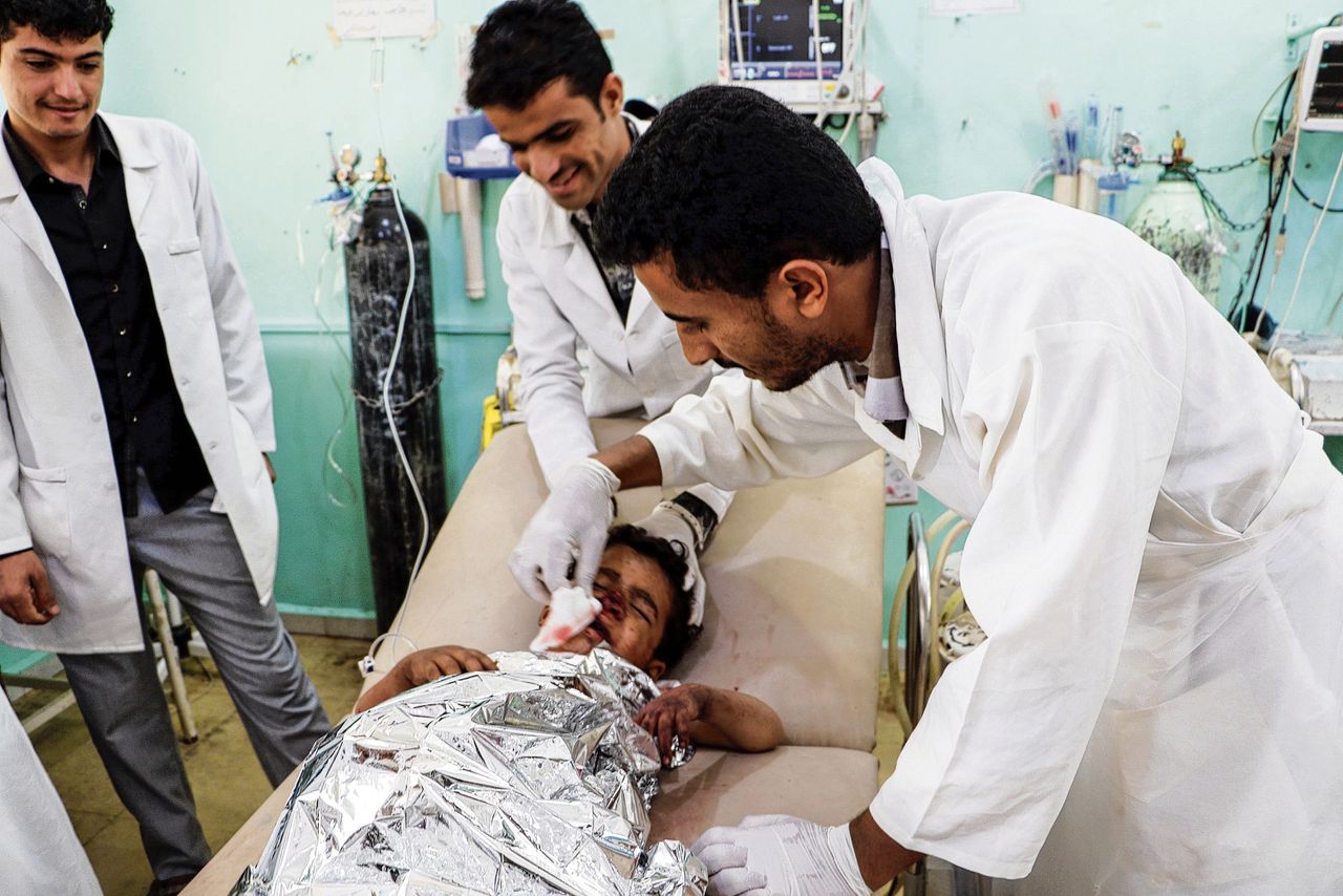 Een kind wordt behandeld in een ziekenhuis in Saada aan verwondingen na de coalitie onder leiding van Saoedi-Arabië.