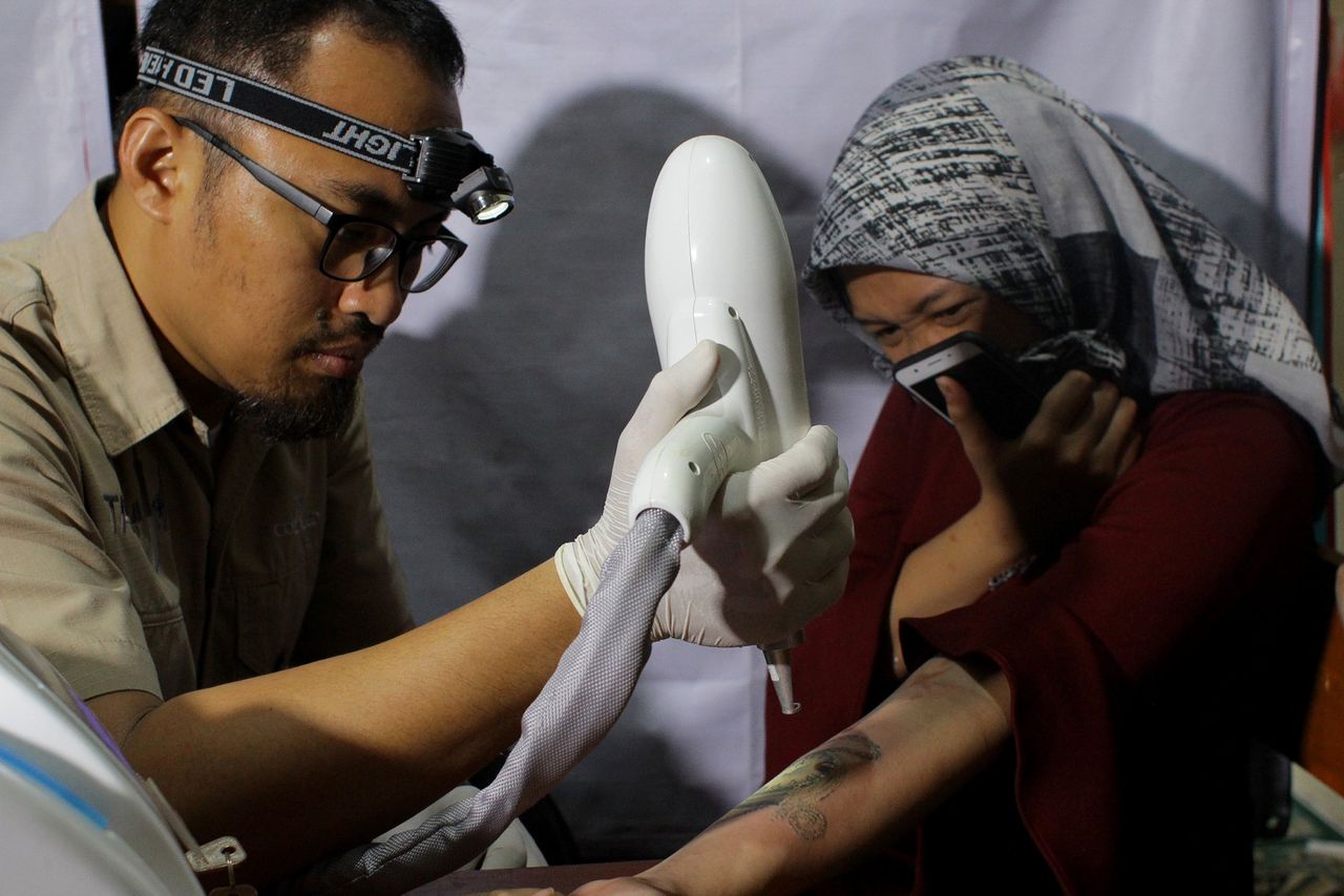 Een moslimvrouw in Jakarta laat gratis haar tatoeage verwijderen door de organisatie Berani Hijrah Baik, vrij vertaald: ‘de durf om te veranderen is goed’.