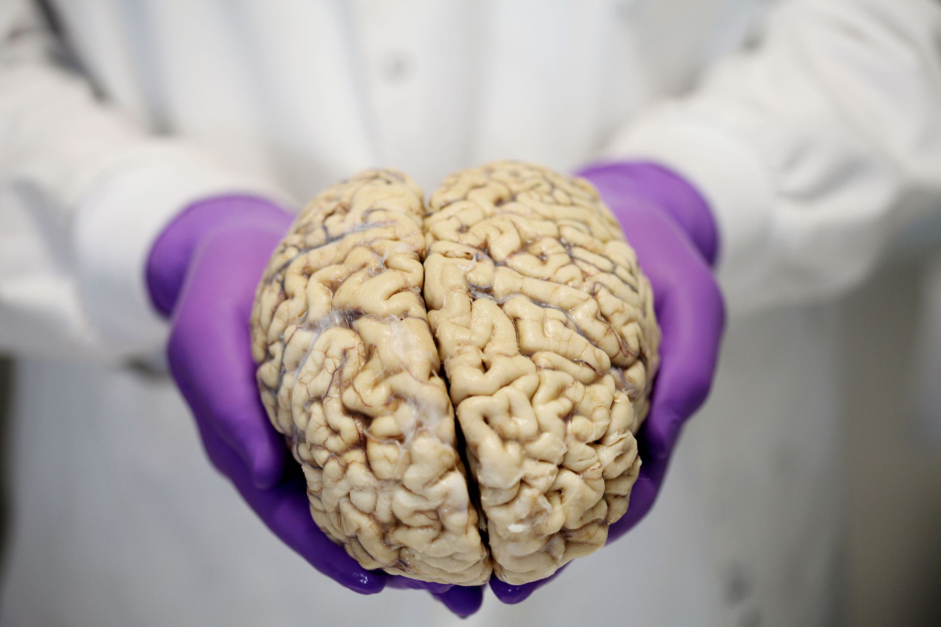Brain фото. Настоящий человеческий мозг. Человеческий мозг живой.