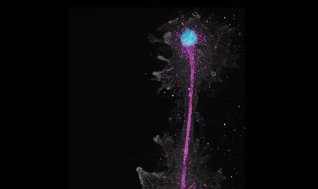 This californian amoeba thrives at a record temperature of 63 degrees celsius