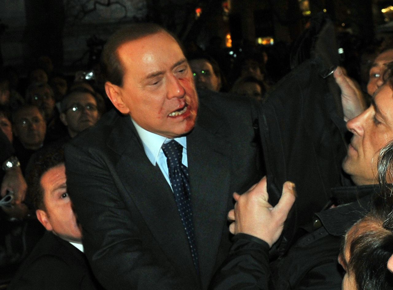 This image made available by the Italian Premier's office shows Italian Premier Silvio Berlusconi after he was punched in the face at the end of a rally in Milan, Italy on Sunday Dec. 13, 2009 by a man holding a small statue in his hand, leaving the 73-year-old media mogul with a bloodied mouth and looking stunned. (AP Photo/ Livio Anticoli/Italian Premier's Office, ho)