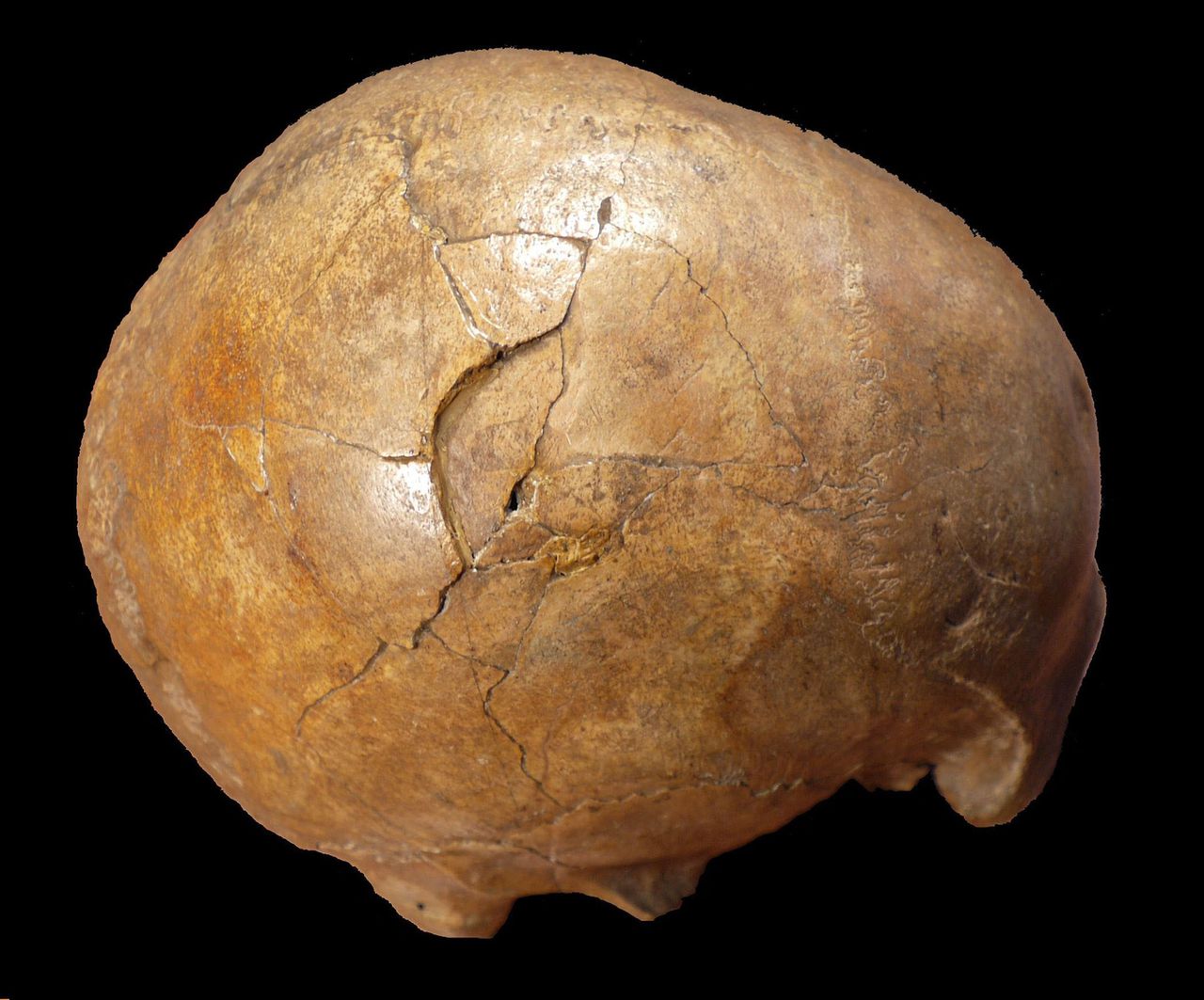 De Roemeense Cioclovina-schedel, met daarop duidelijk zichtbaar de sporen van een harde klap