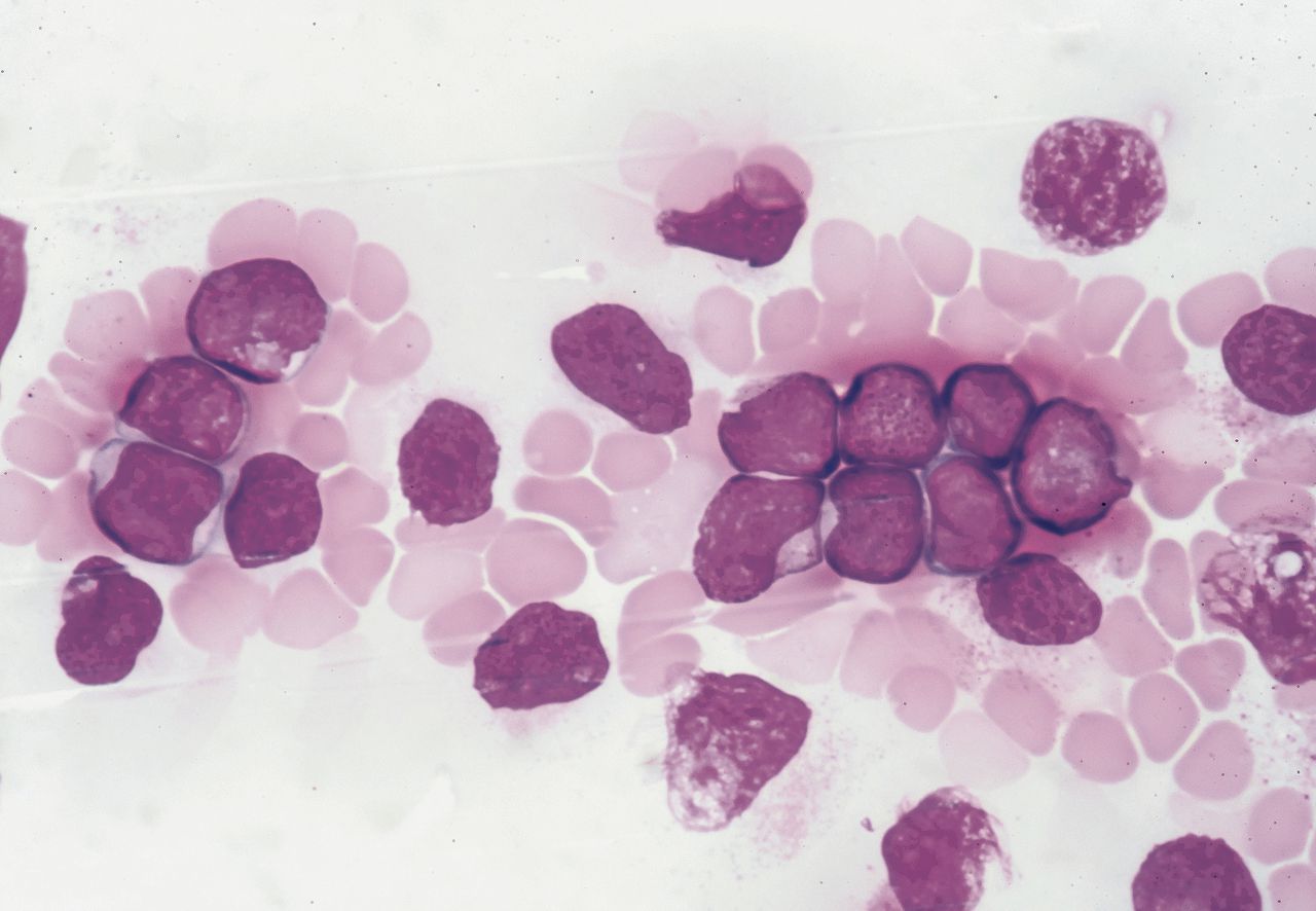 Genetische test zou afwijkingen snel kunnen opsporen 