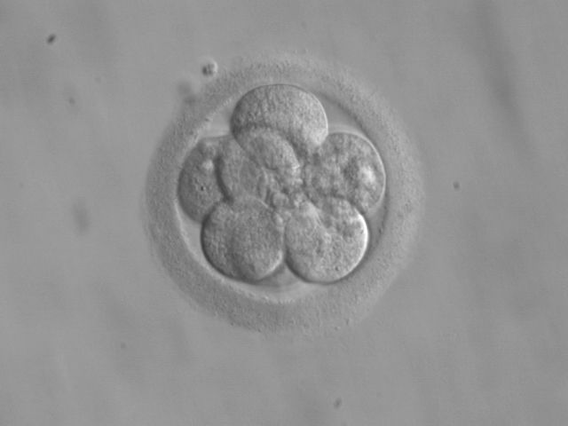 Menselijk embryo van drie dagen oud. Het embryo bestaat in dit stadium uit acht cellen.