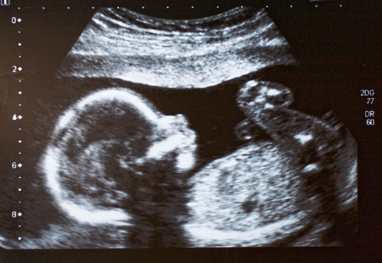 Ouders met kans op een kind met een erfelijke ziekte kunnen een gezond embryo laten selecteren.