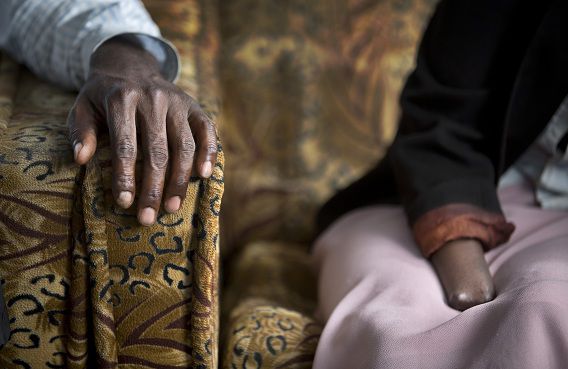 Links de hand van Emmanuel Ndayisaba. Rechts de stomp van Alice Mukarurinda. Zij verloor haar hand en haar baby. Hij bediende de hakbijl die dat inrichtte. Nu zijn ze vrienden. Ze wonen in dezelfde buurt en doen boodschappen bij dezelfde winkel.