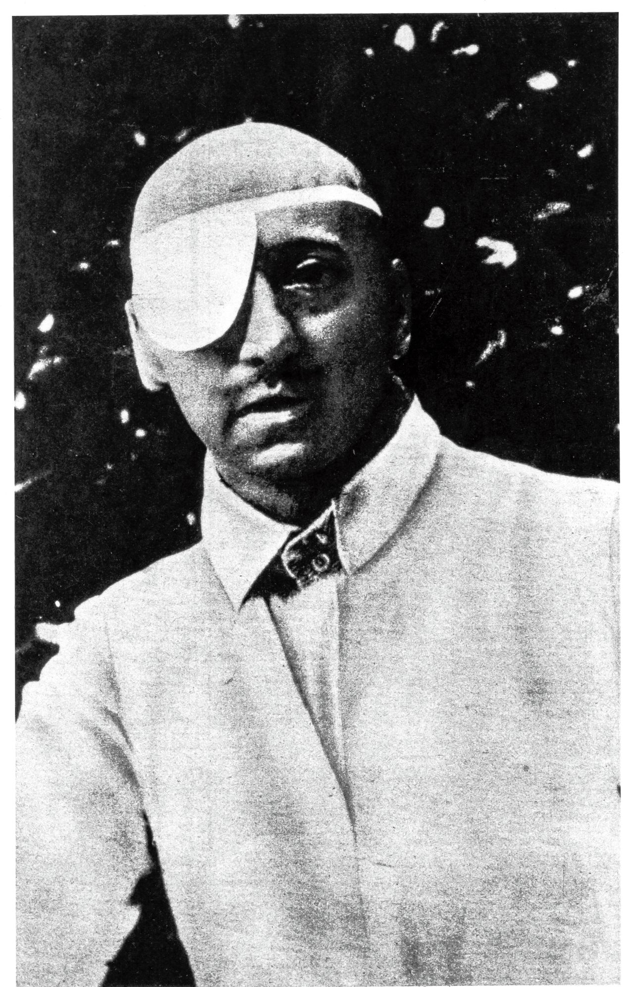 Gabriele D’Annunzio verloor in de Eerste Wereldoorlog zijn rechteroog
