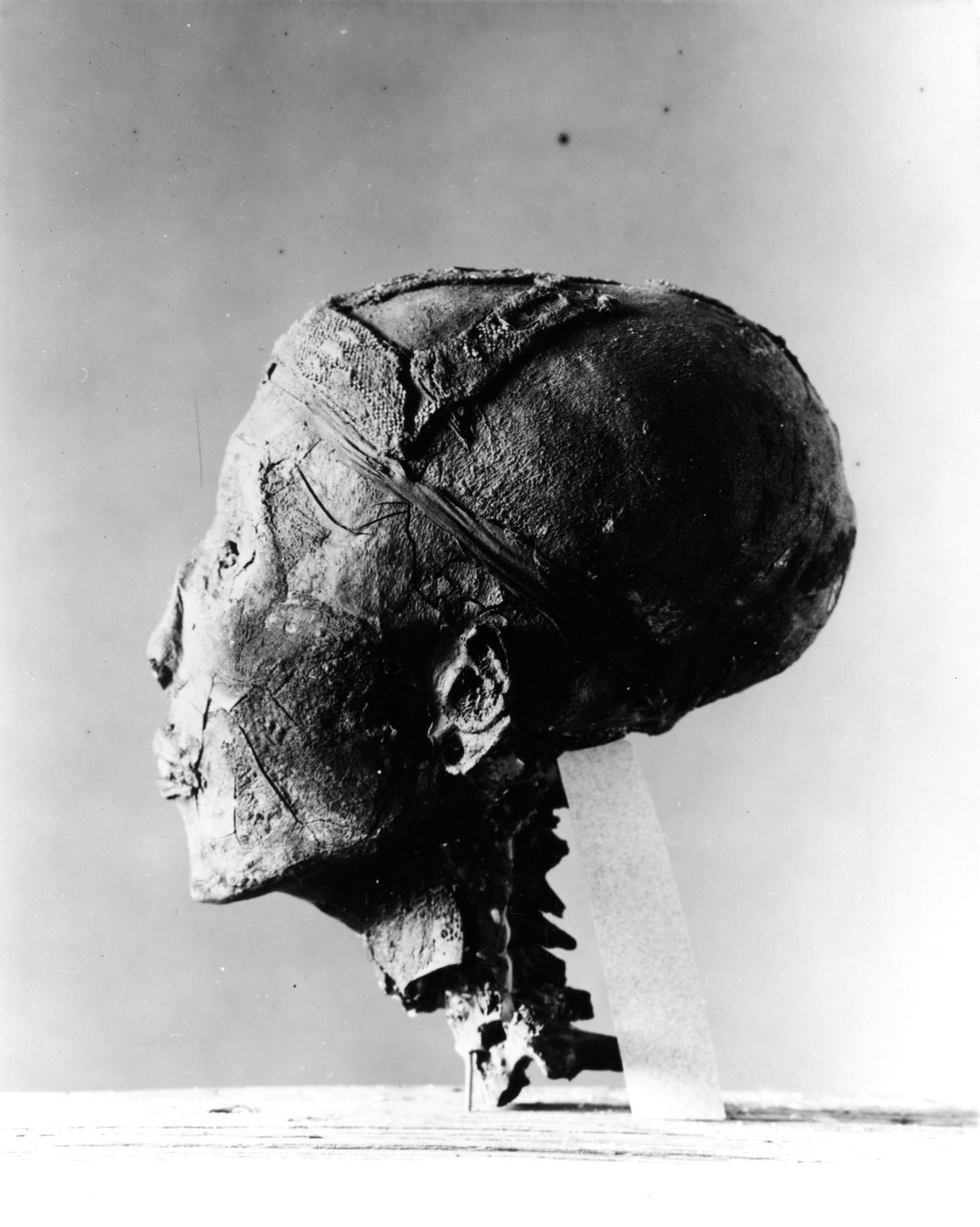 Gemummificeerd hoofd van Toetanchamon, gestorven rond het jaar 1317 v.Chr en gefotografeerd in 1925 door Harry Burton (1879 - 1940), drie jaar na het openen van het tot dan toe ongeschonden graf van deze Egyptische farao.