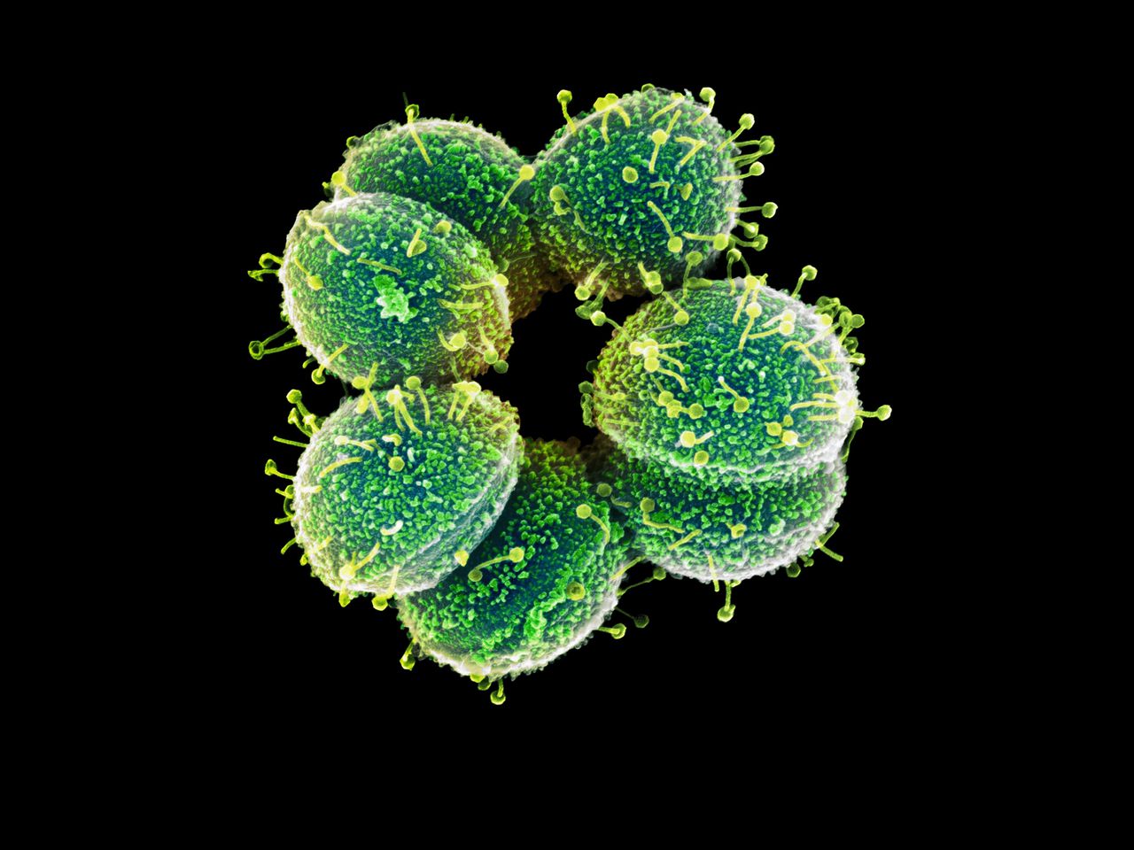Jumbovirussen zijn vijanden van bacteriën – en meer 