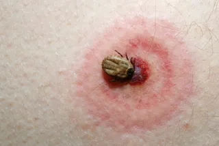 Testen na de teek - NRC