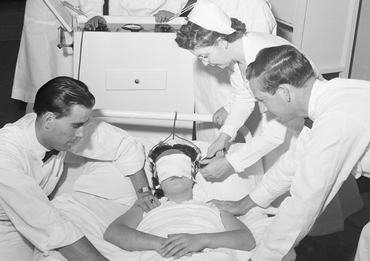 Demonstratie door Amerikaanse artsen uit de begintijd van de elektroconvulsieve therapie, in 1942, toen nog zonder verdoving.