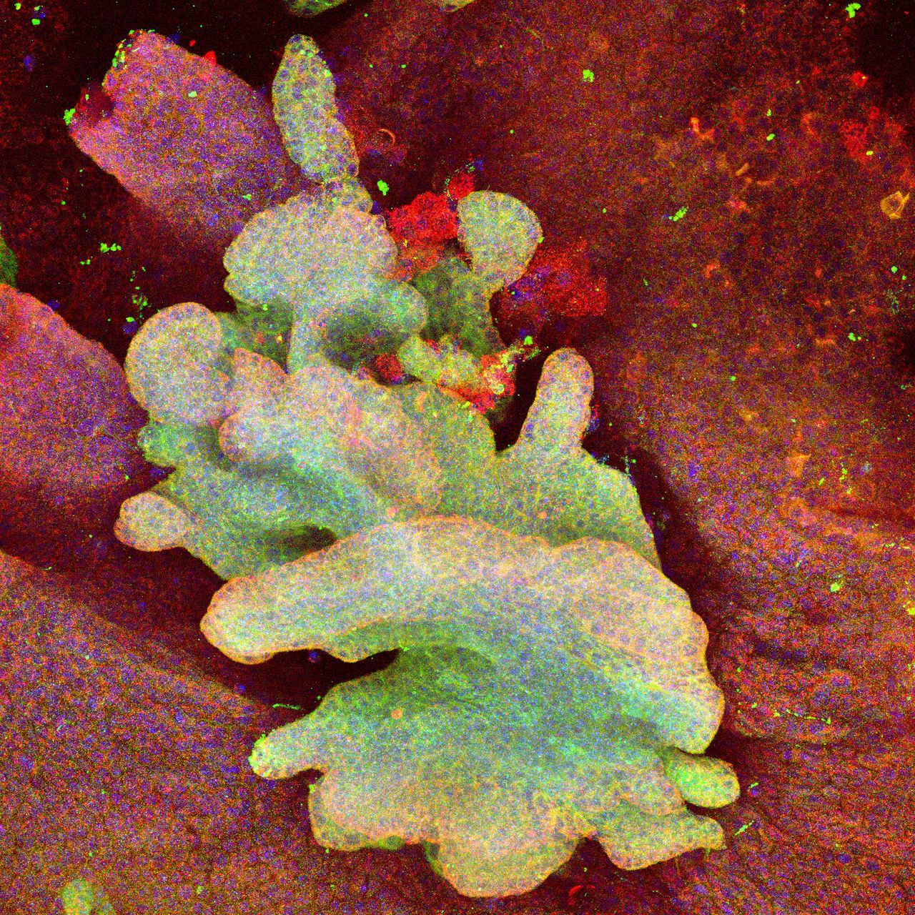 De groengekleurde kankercellen in de opperhuid van een muizenstaart zijn duidelijk zichtbaar tegen de achtergrond van de roodgekleurde normale huidcellen. Zo’n tumor kan groeien uit één enkele gemuteerde stamcel.