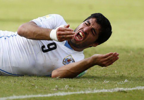 Luis Suárez acteert bezorgdheid om zijn gebit nadat de Uruguayaanse spits enkele seconden eerder zijn tanden in de schouder van Giorgio Chiellini zette.