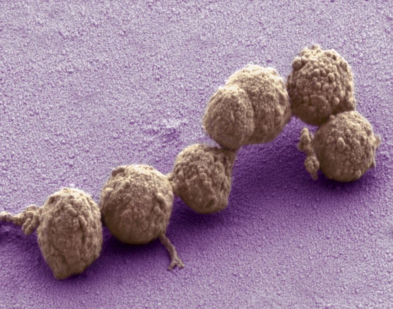 Wetenschappers vrezen ‘spiegelbacteriën’ en roepen op om te stoppen met deze tak van de biotechnologie