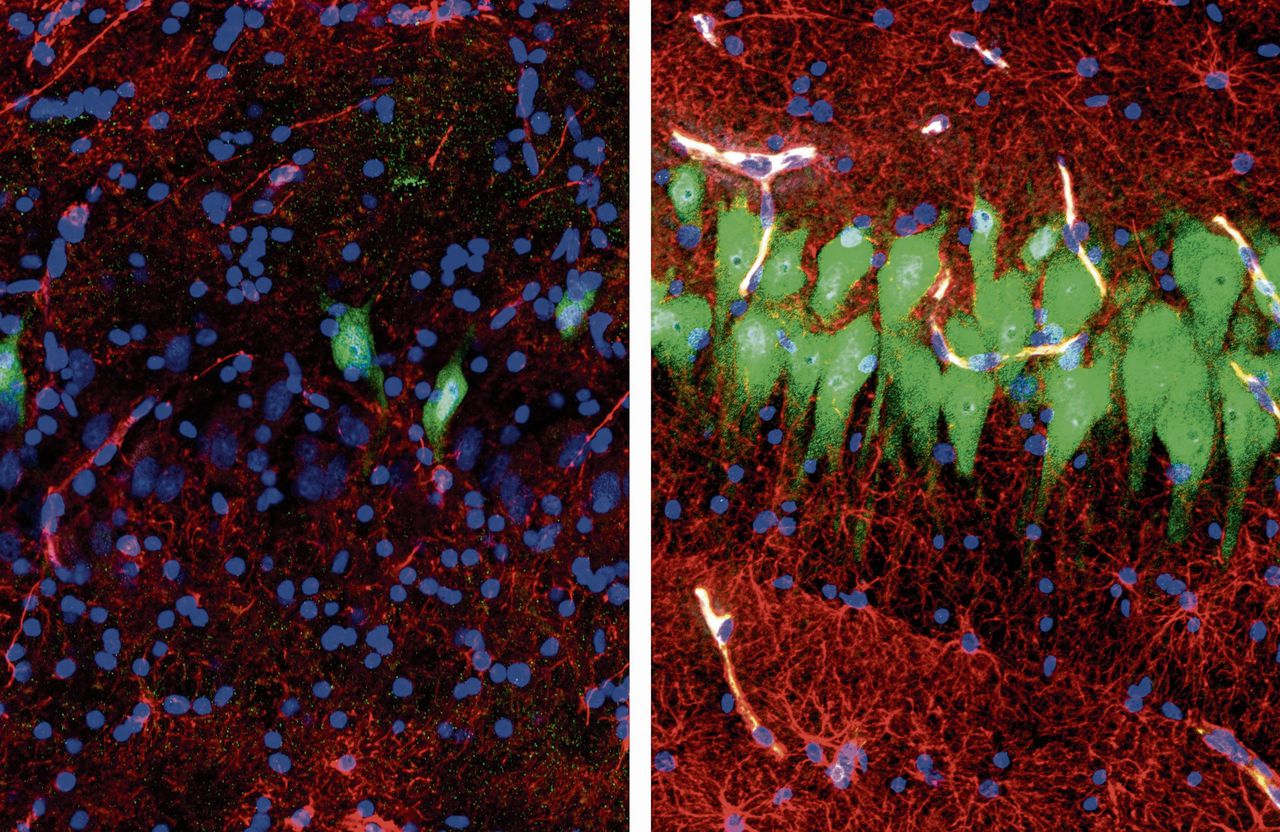 Links: onbehandeld varkensbrein, tien uur na het slachten. Rechts: geslacht varkensbrein tien uur na perfusie. De groene cellen zijn levende neuronen.