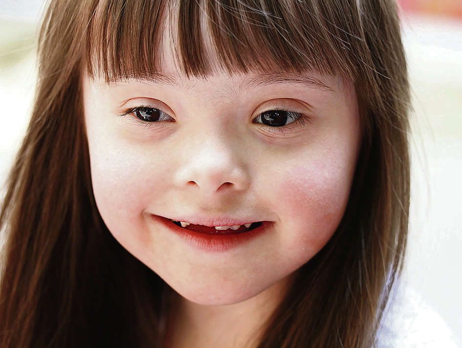 Extra chromosoom bij Down stoort alle genen - NRC