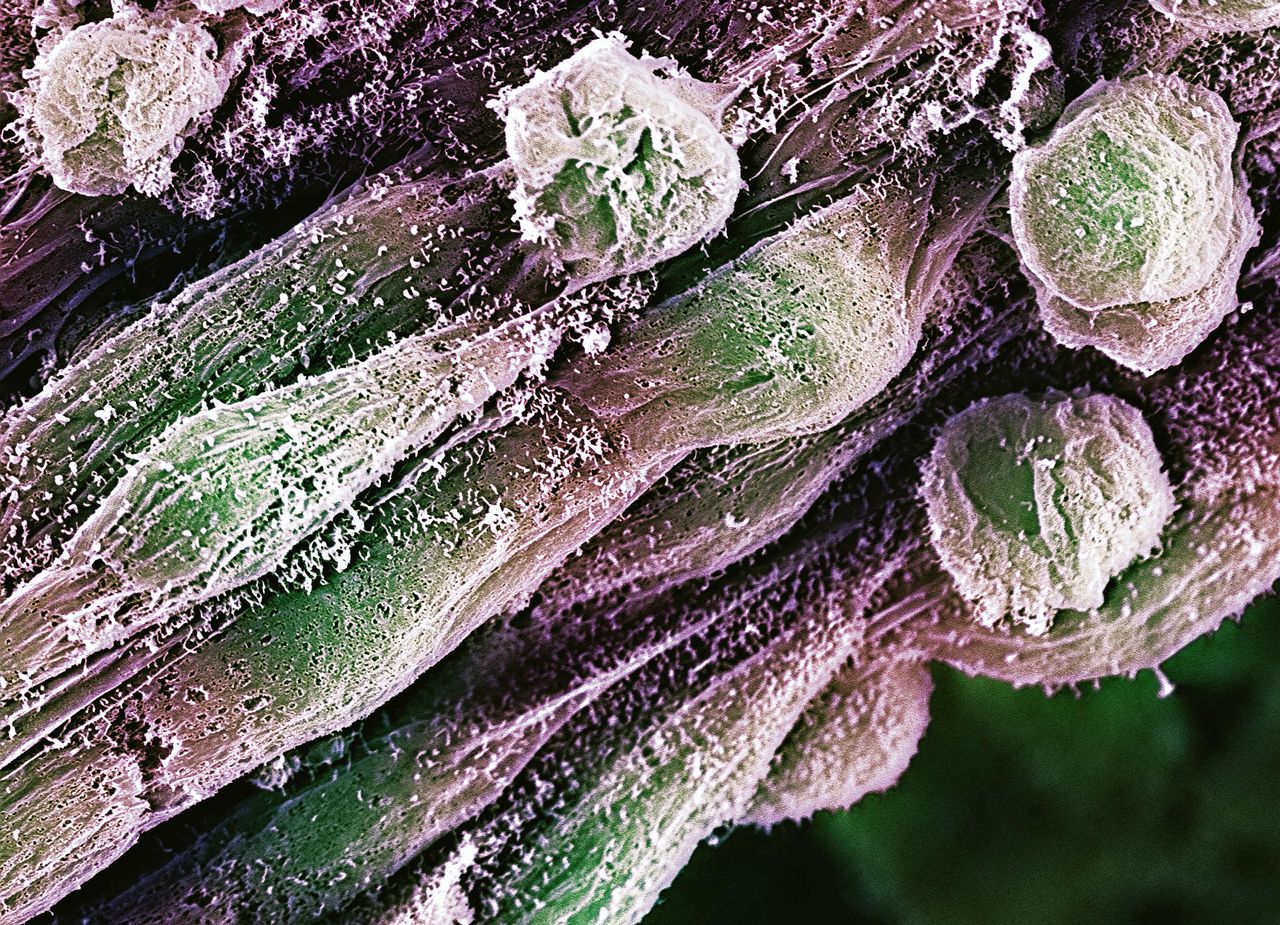 Menselijke embryonale stamcellen in kweek, gefotografeerd met een scanning elektronen microscoop. Uit deze cellen kunnen in principe alle denkbare weefsels opgekweekt worden.