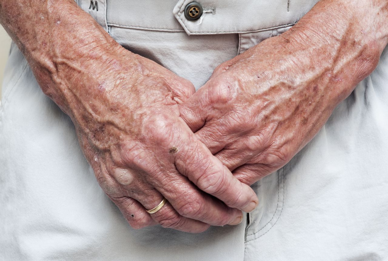 Mannen krijgen eerder rimpels, maar vrouwen halen hen later in 