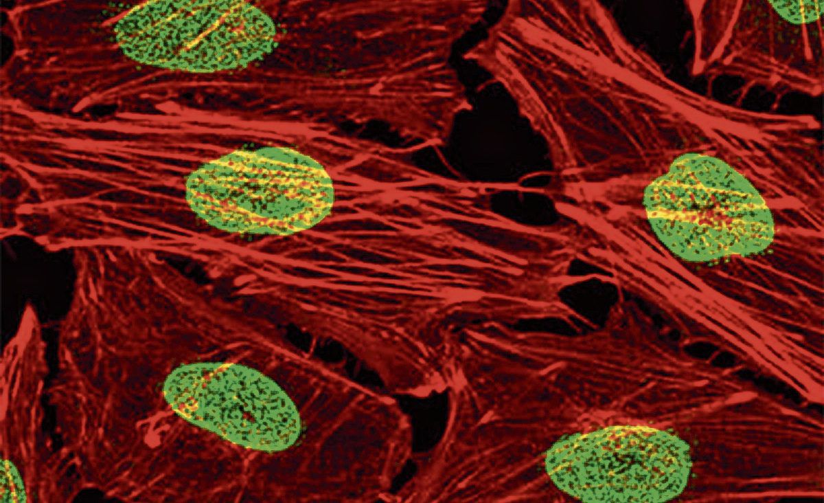 In deze melanoomcellen zijn de talrijke kernporiën groen gekleurd. De structuurvezels in de cel zijn rood gekleurd.