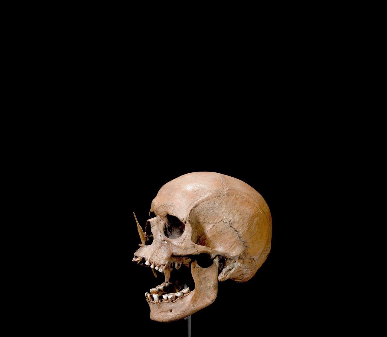 De schedel van een man die 45.000 dodelijk werd getroffen door een pijl. Onder andere diens dna is voor het onderzoek gebruikt.
