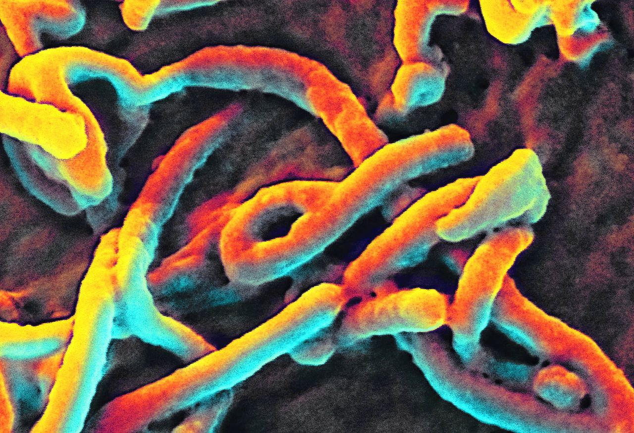 Ernst van de ziekte loopt niet in de pas met ebolavirus in het bloed en