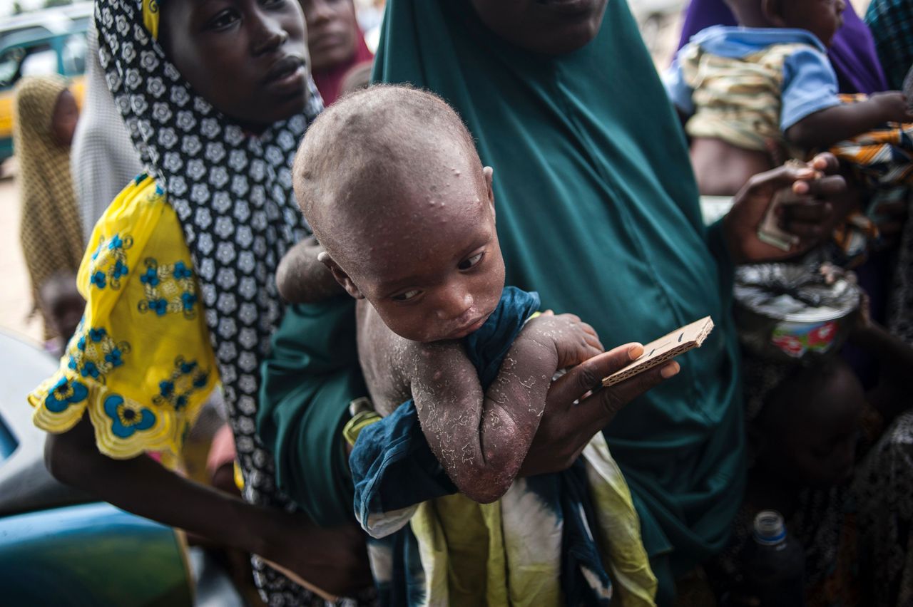 Een vrouw houdt haar kind vast in een rij voor een voedingskliniek van Unicef Maiduguri.
