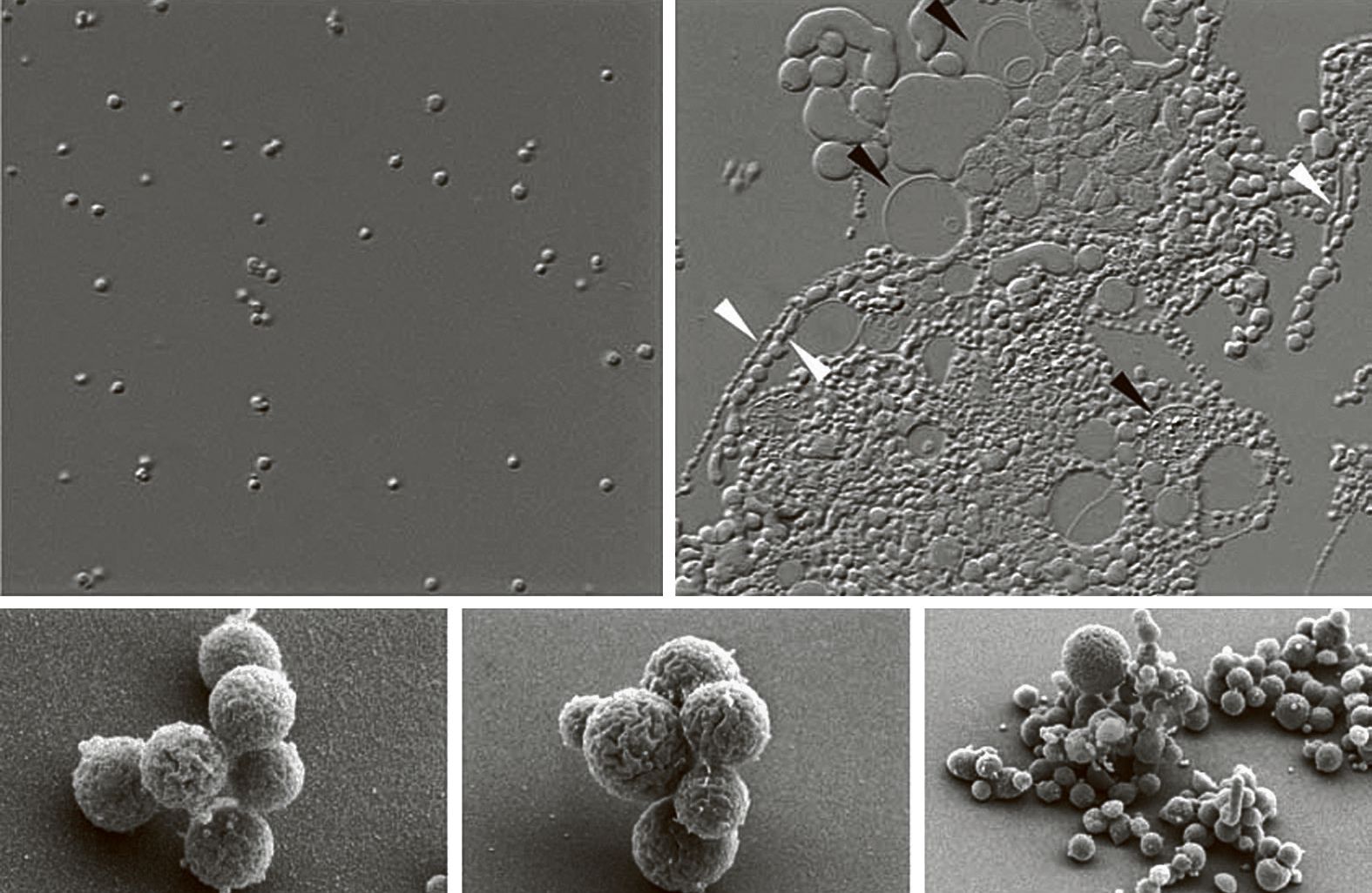 Искусственно созданные организмы. Mycoplasma Laboratorium Синтия. Синтетическая бактерия Синтия. Бактерия Синтия под микроскопом. Первая синтетическая бактериальная клетка.