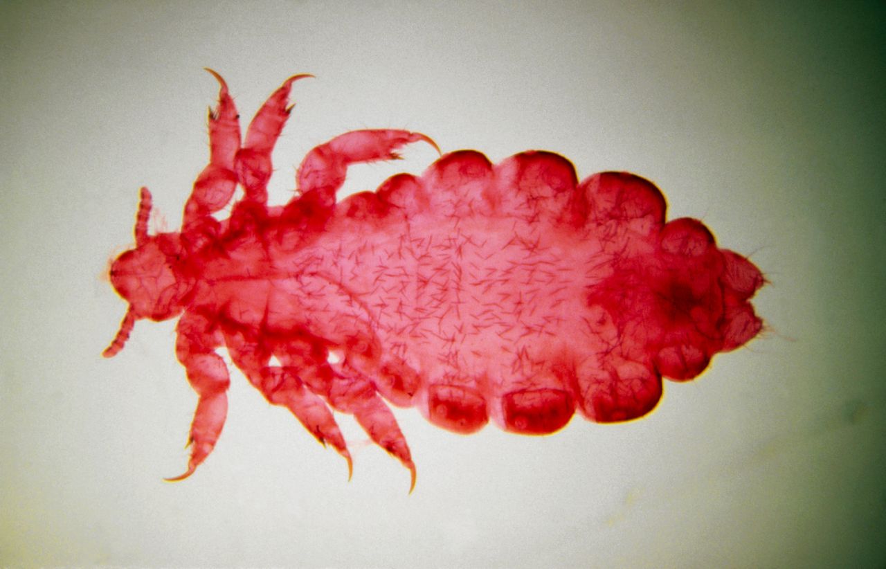 When people started wearing woolen clothing, a nasty bacterium saw a new chance to spread