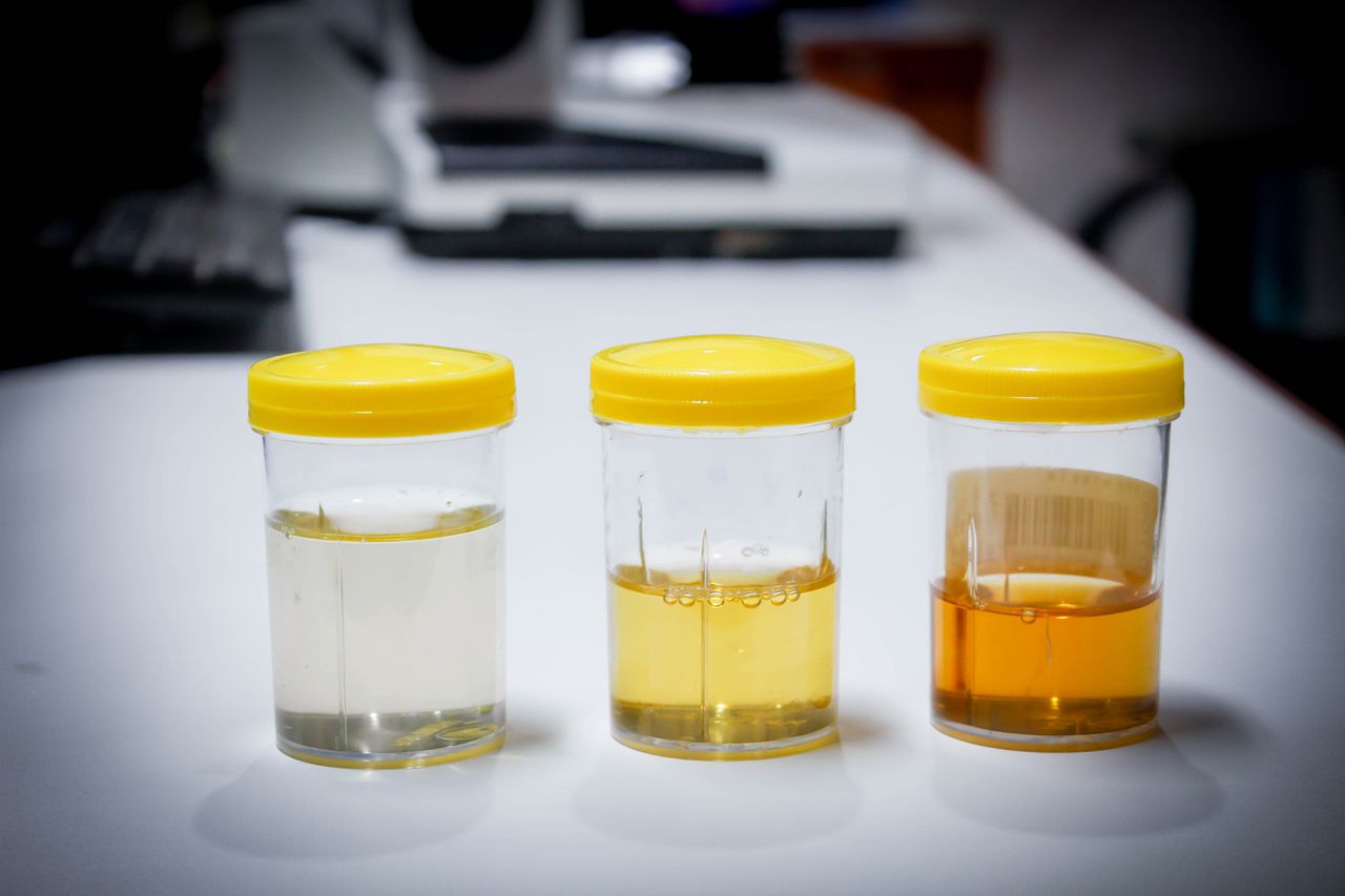 Wat kleurt urine geel? NRC