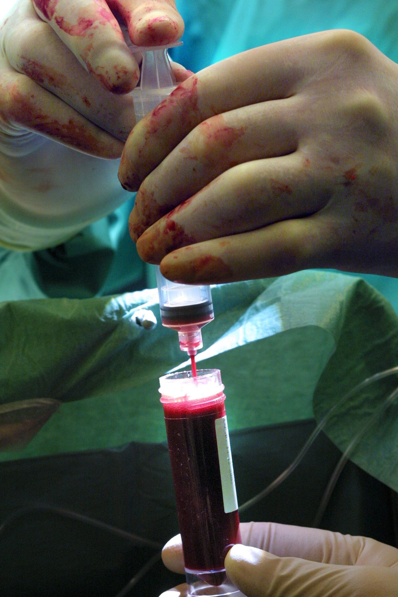 Keer op keer zat de dokter fout - NRC