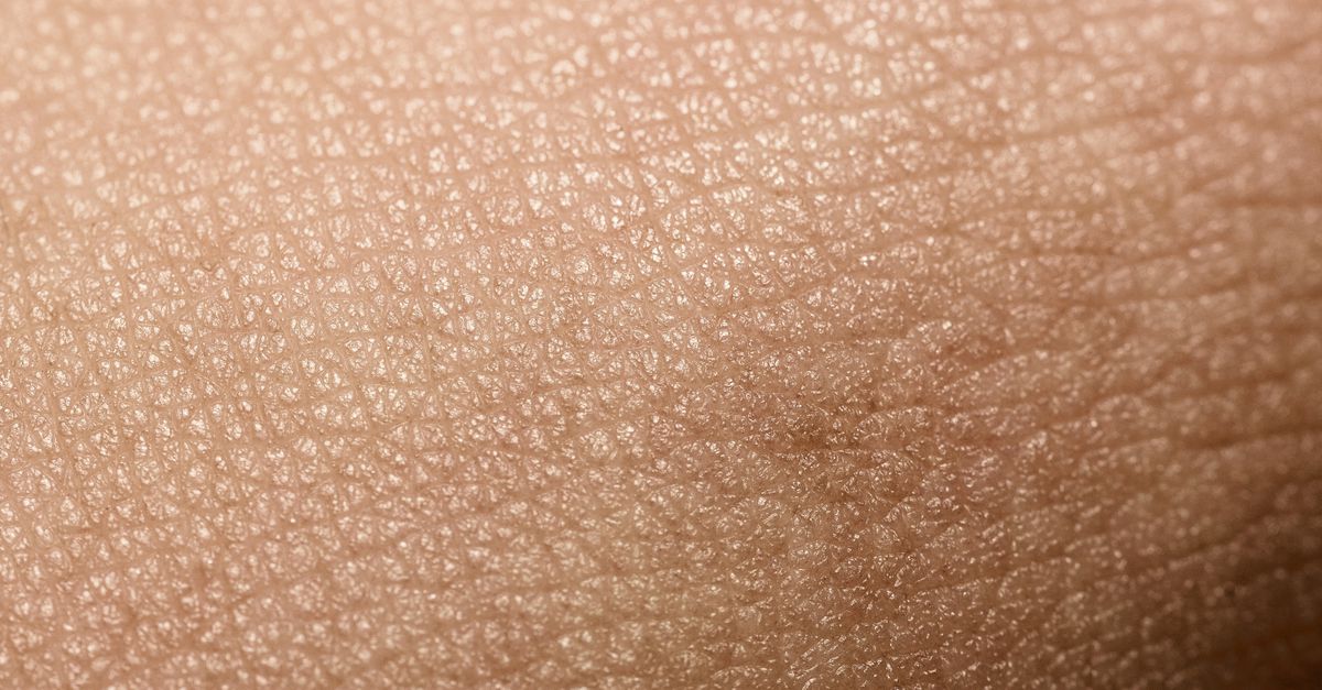 Wat Doet Een Splinter In Je Lichaam Nrc