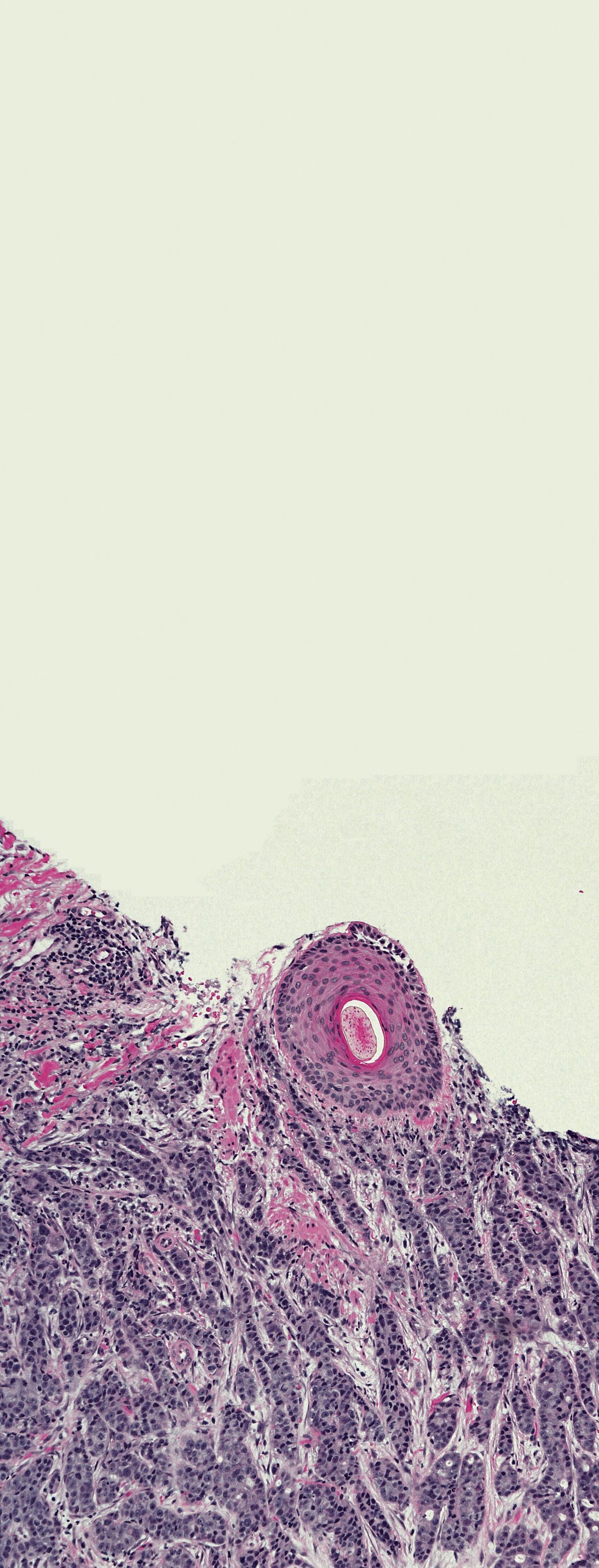 Kankercellen onder de microscoop
