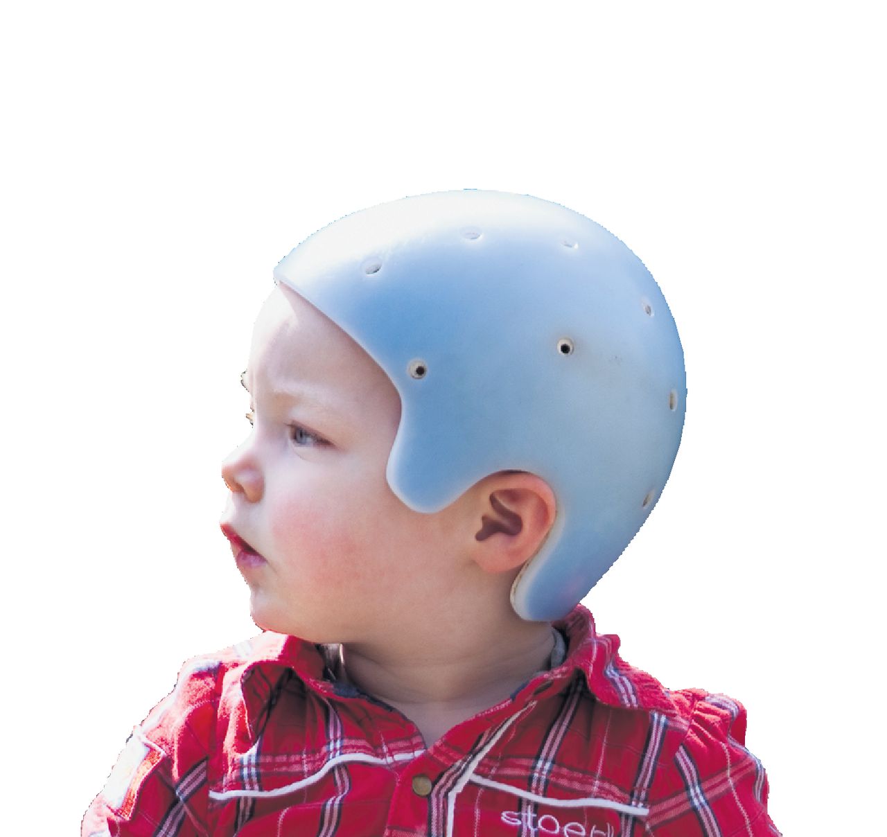 Helmtherapie Voor Mooiere Baby Binnenland 6 7 Nrc
