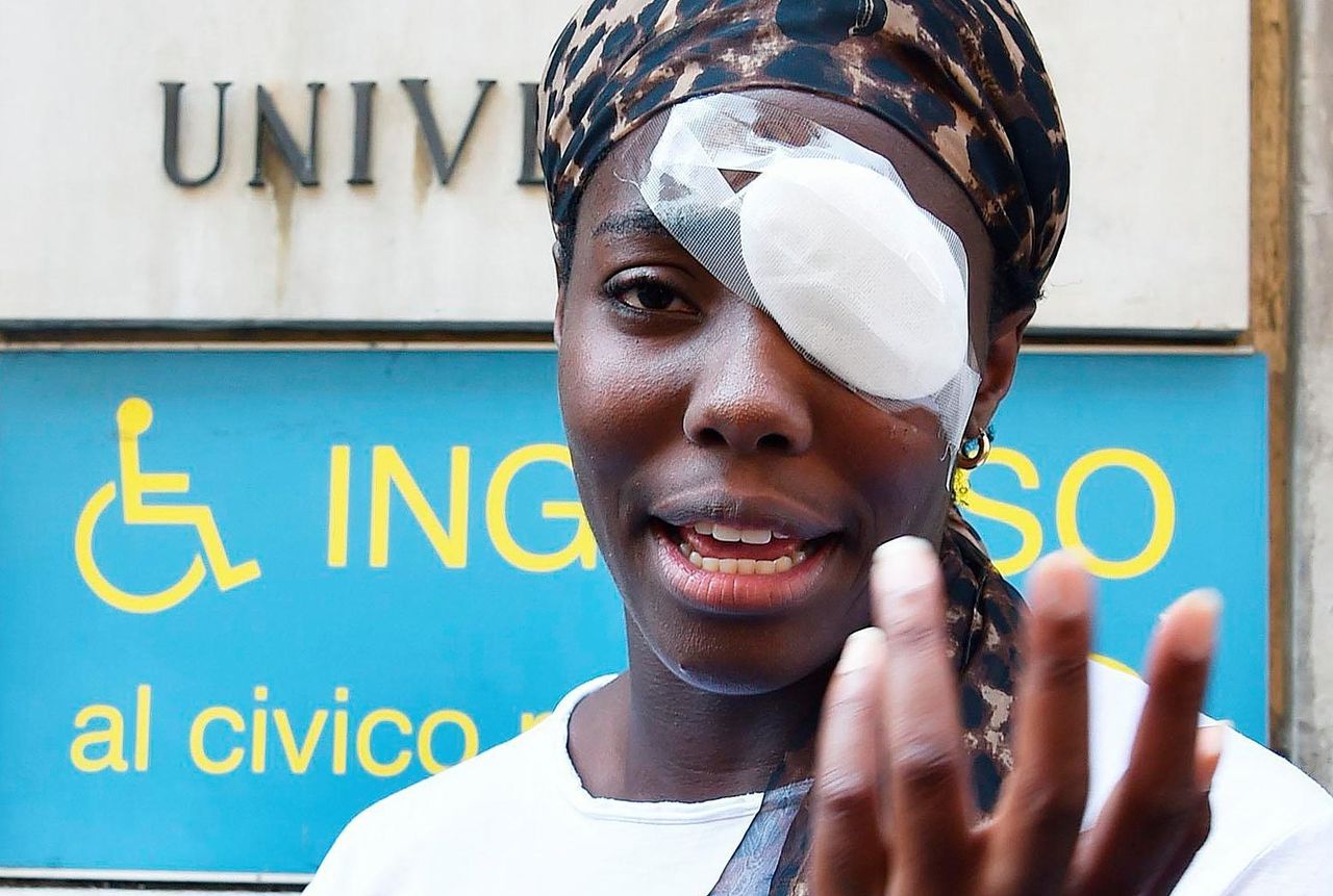 Zondagavond kreeg Daisy Osakue een ei in haar oog dat vanuit een rijdende auto werd gegooid.