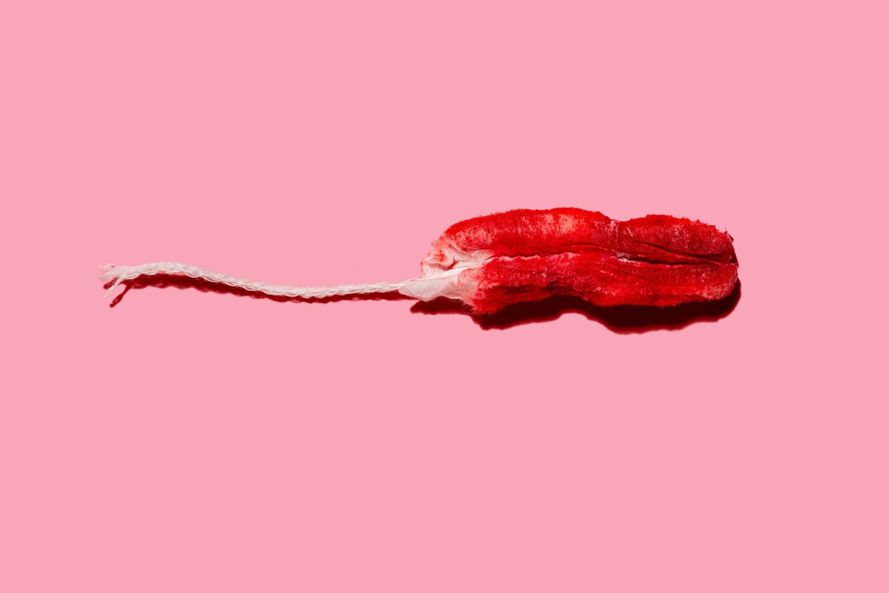 Helpt minder menstrueren tegen bloedarmoede? 