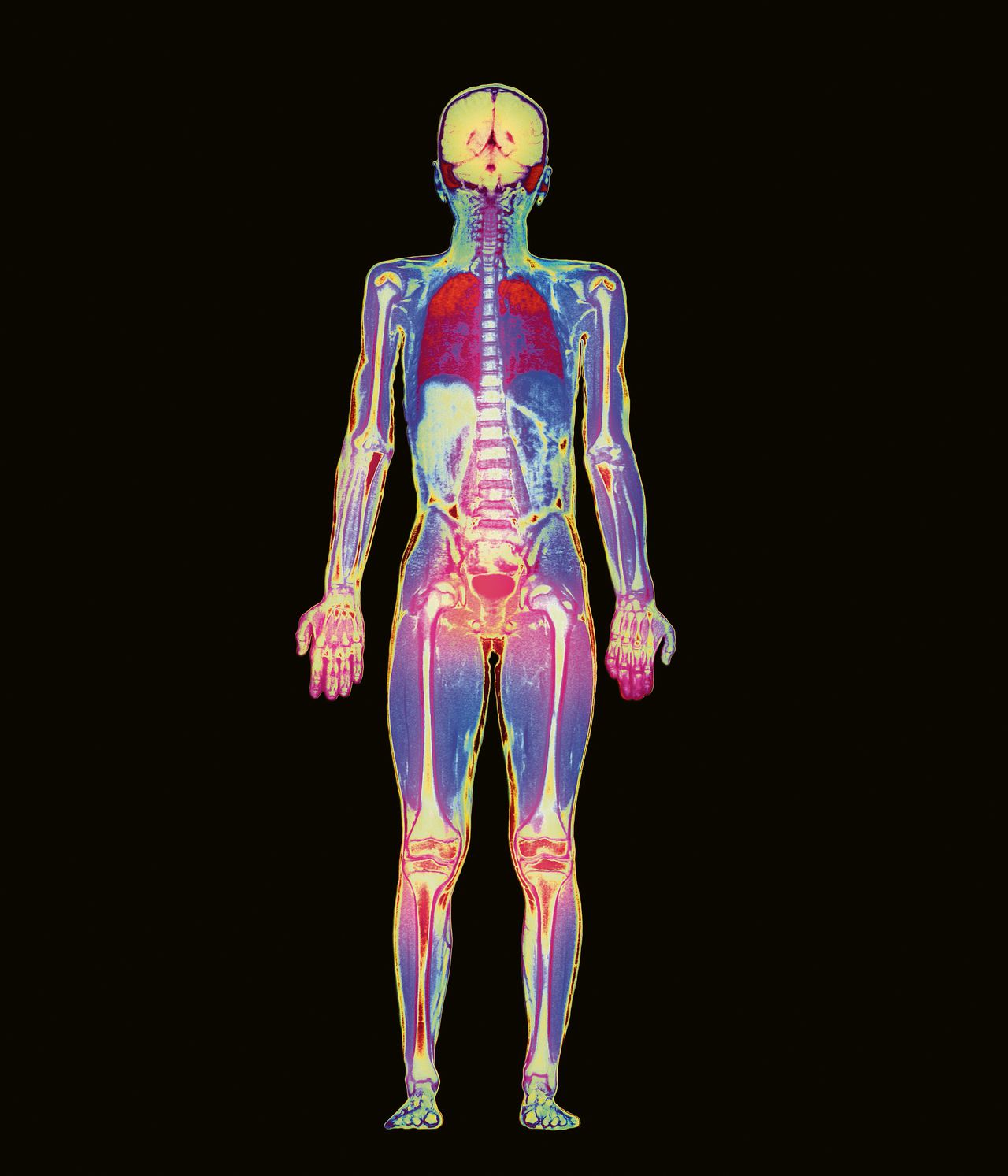 MRI-scan van een jongen van 9. Aan het verzamelen en verwerken van medische data kleven privacyrisico’s.