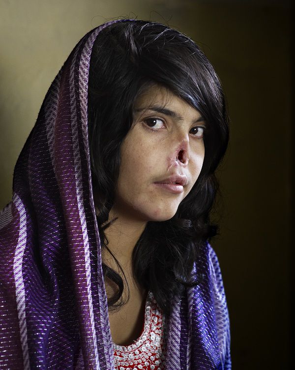 World Press Photo of the Year 2010 Jodi Bieber, South Africa, Institute for Artist Management for Time magazine Bibi Aisha, an 18-year-old woman from Oruzgan province in Afghanistan, who fled back to her family home from her husbandÕs house, complaining of violent treatment. The Taliban arrived one night, demanding Bibi be handed over to face justice. After a Taliban commander pronounced his verdict, BibiÕs brother-in-law held her down and her husband sliced off her ears and then cut off her nose. Bibi was abandoned, but later rescued by aid workers and the American military. After time in a womenÕs refuge in Kabul, she was taken to America, where she received counseling and reconstructive surgery. Bibi Aisha now lives in the US.