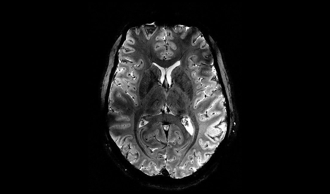Ongekend scherp beeld van de hersenen uit een Franse MRI-scanner 