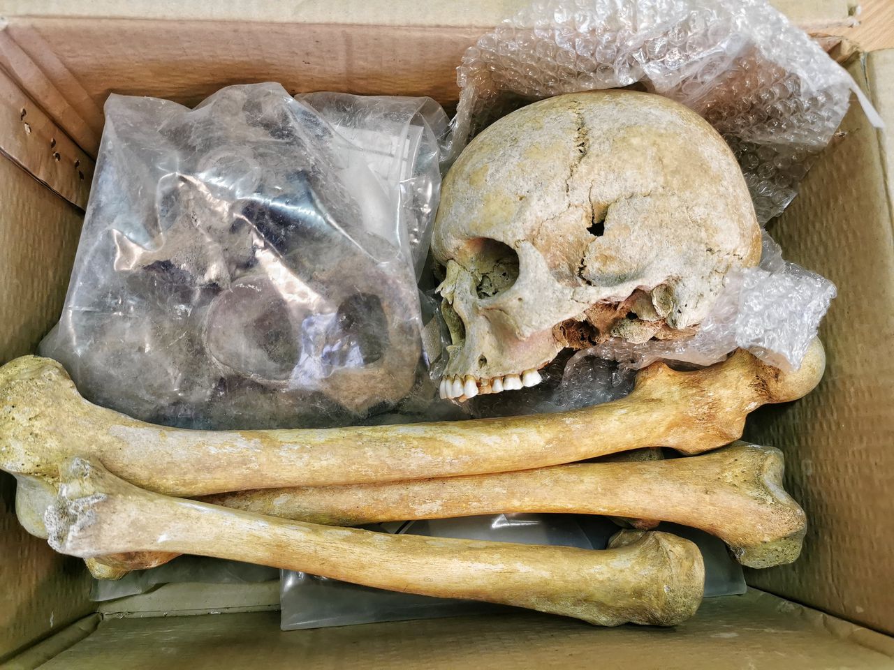 Na vier decennia op een Belgische zolder kwam deze doos met het skelet van een Pruisische soldaat boven water.