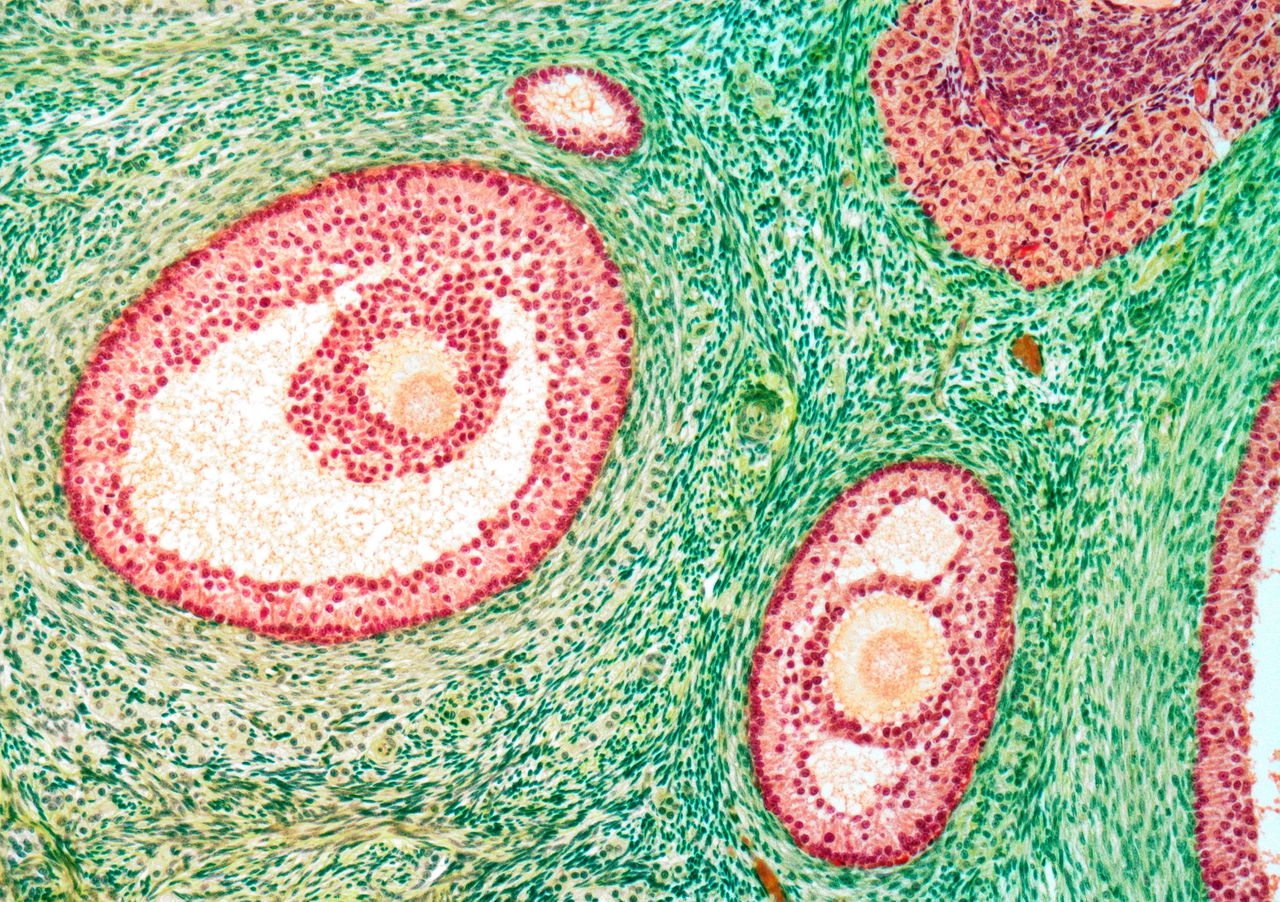 Aangekleurde microscoop-opnames van follikels in eierstokken, met daarin uitgroeiende eicellen (donker oranje). In de menopauze stopt dit proces.